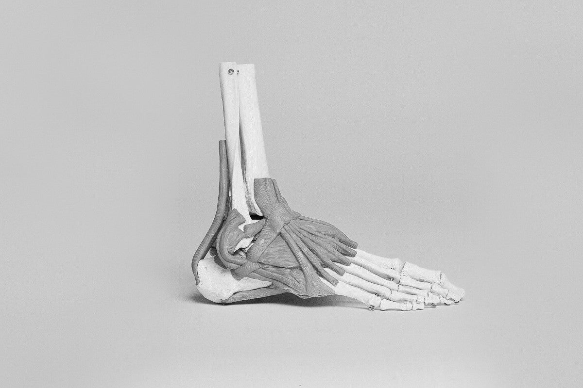 foot bones skeletal model for plantar fasciitis symptom identification