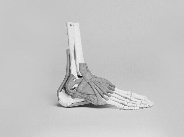 foot bones skeletal model for plantar fasciitis symptom identification